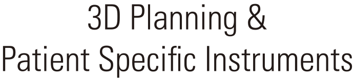 3D Planning & Patient Specific Instruments